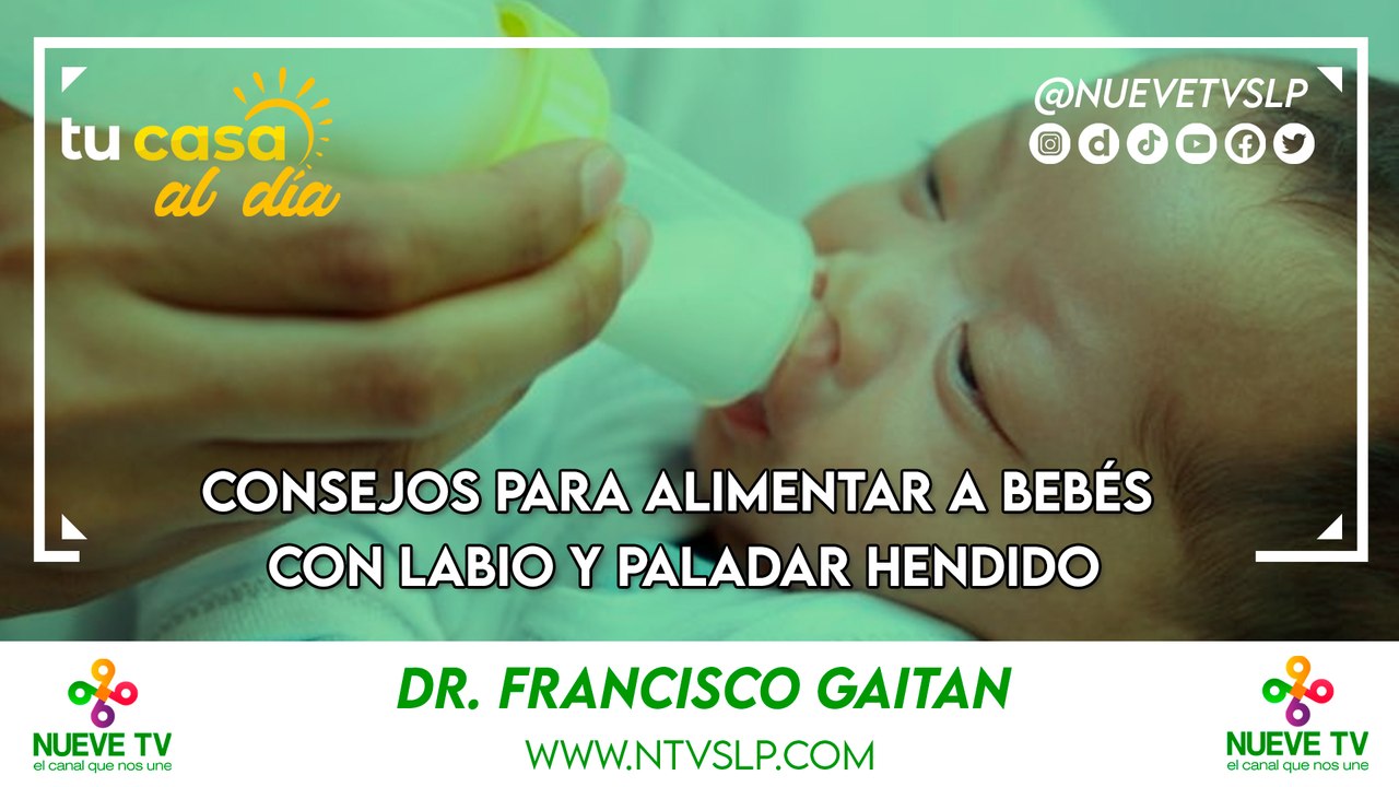 Consejos para Alimentar a Bebés con Labio y Paladar Hendido