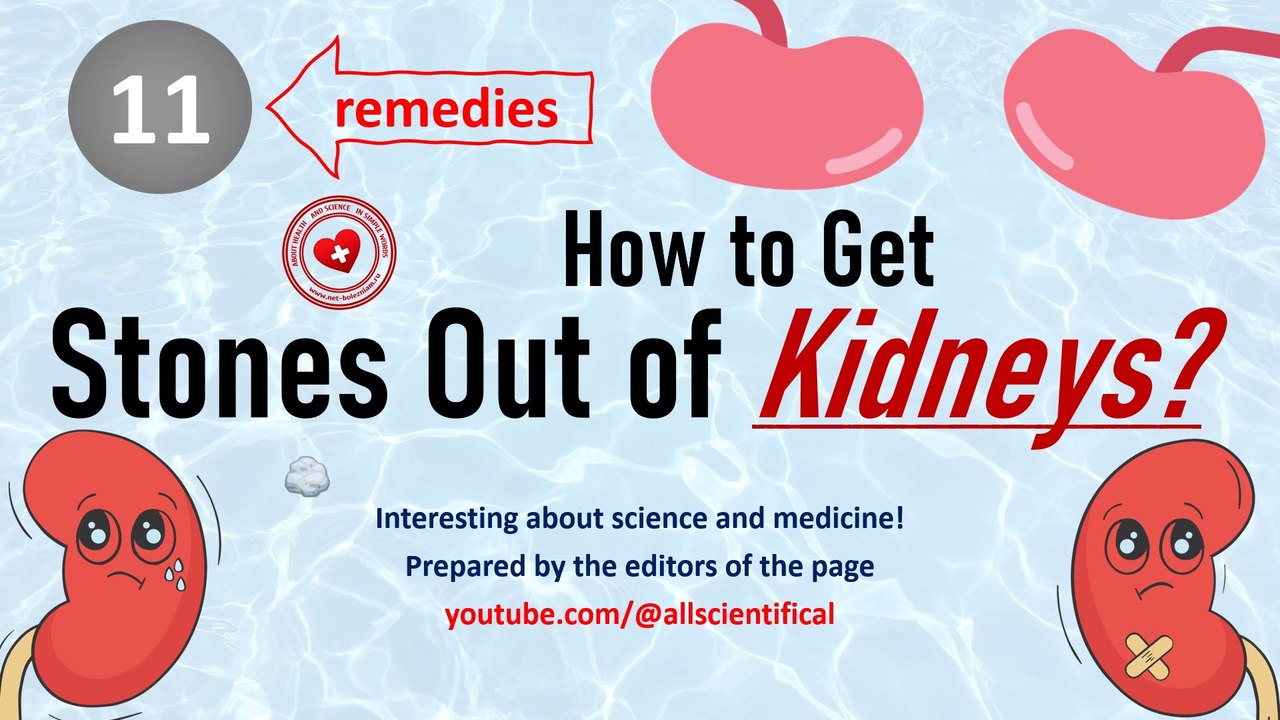 How to remove kidney stones: 11 remedies (methods) for the treatment of urolithiasis
