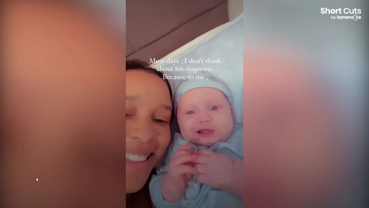 Des parents noirs donnent naissance à un bébé albinos aux cheveux roux