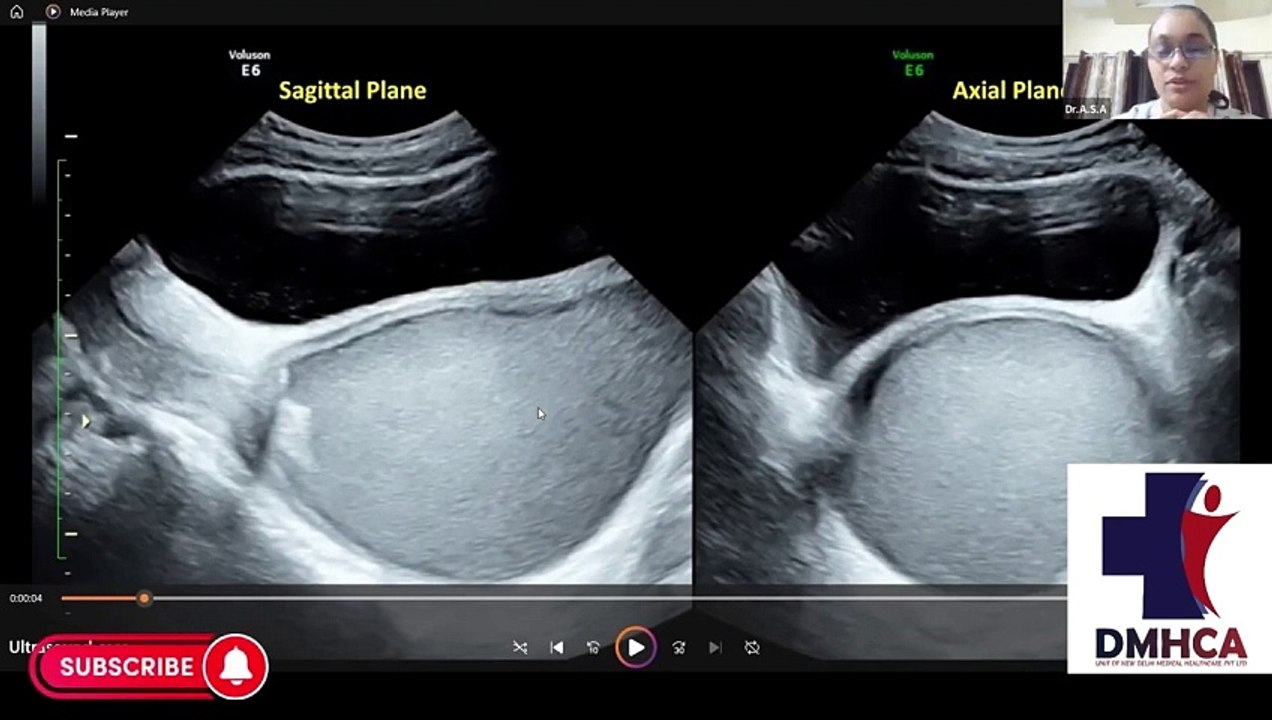 Ultrasonography Demo Class(Fellowship & PG Diploma Courses for doctors)