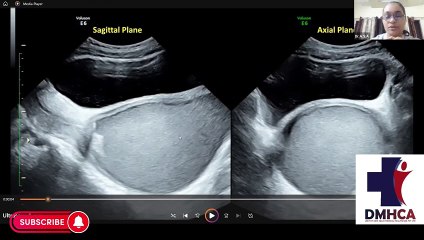 Ultrasonography Demo Class(Fellowship & PG Diploma Courses for doctors)