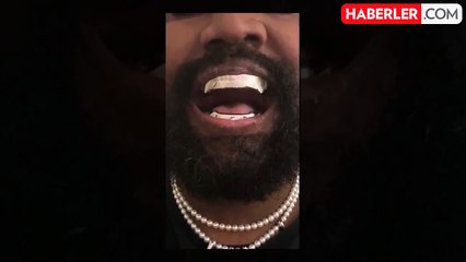 Kanye West, 850 bin dolarlık titanyum protez diş taktırdı