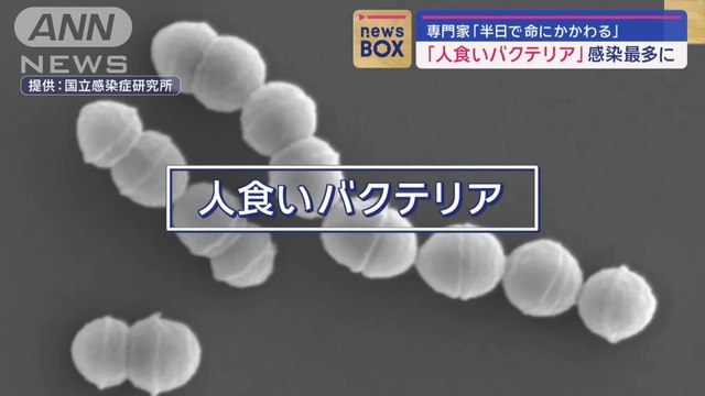 人食いバクテリア感染最多に 専門家半日で命にかかわるスーパーJチャンネル(2024年1月18日)