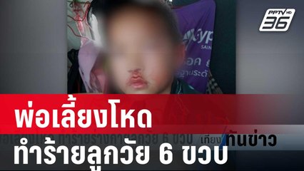 พ่อเลี้ยงโหด ทำร้ายร่างกายลูกวัย 6 ขวบ | เที่ยงทันข่าว | 19 ม.ค. 67