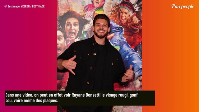 Rayane Bensetti : Les pompiers appelés à son chevet, images impressionnantes de son visage déformé