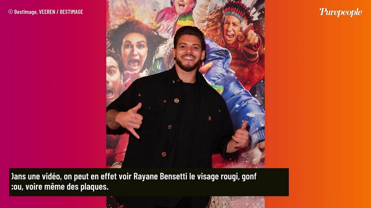 Rayane Bensetti : Les pompiers appelés à son chevet, images impressionnantes de son visage déformé