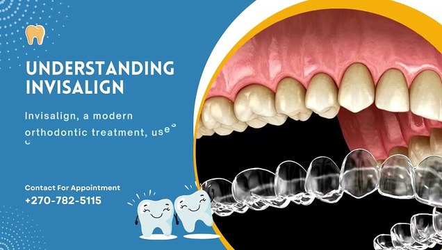 Invisalign Clear Aligners Revealed: Unlocking Secrets in Bowling Green!