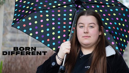 I'm Allergic To Water - And People Ask Me If I Shower | BORN DIFFERENT