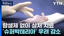 [과학 한스푼] 항생제 없이도 덧나지 않고 피부 상처 치료한다 / YTN