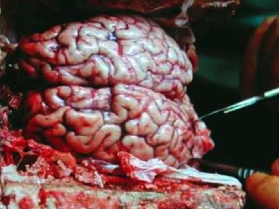 Brains and Turds YT2