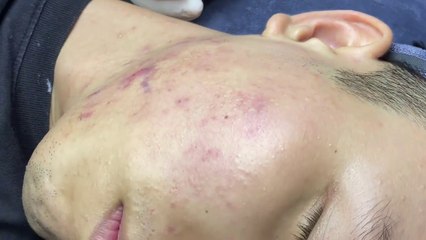 satisfying relaxation skin video with spa