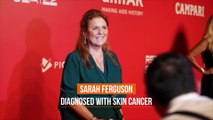 Sarah Ferguson diagnosed with skin cancer