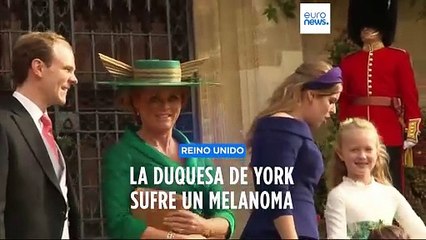 Sarah Ferguson diagnosticada de cáncer de piel