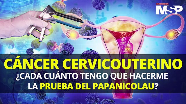 ¿Qué es la Prueba de Papanicolaou y por qué es vital para prevenir cáncer cervicouterino? - #MSP