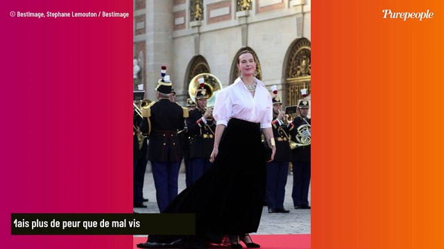 PHOTO Carole Bouquet victime d'un accident : 30 points de suture et changement de programme pour l'actrice