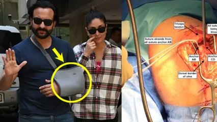 Tricep Surgery Kya Hoti Hai | Saif Ali Khan Tricep Surgery Recovery Time | Boldsky