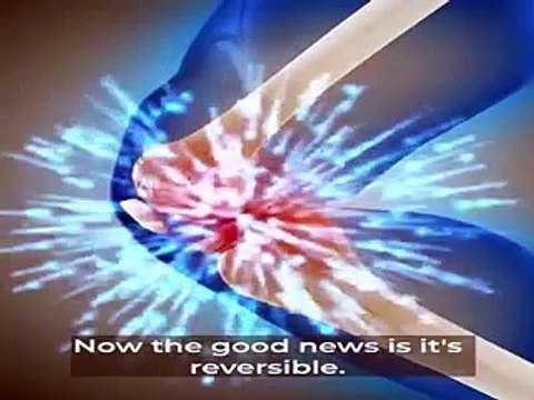 Revitalize Your Knees with Nooro's Advanced 3-in-1 Massager - Unveiling the Ultimate Pain Relief Solution!