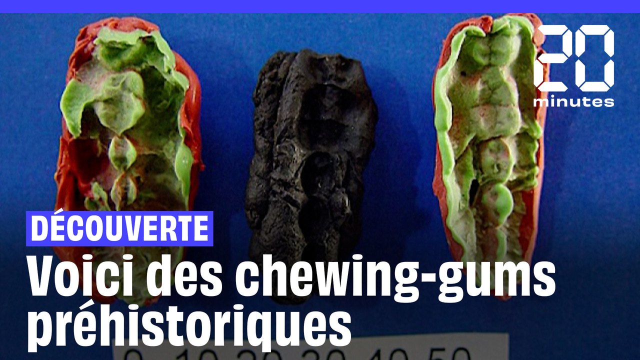 Suède : Les secrets de chewing-gums préhistoriques révélés