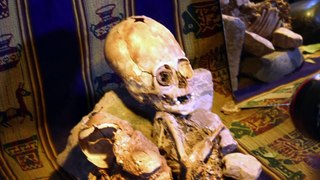Ancient Aliens - Paracas Skull DNA Test