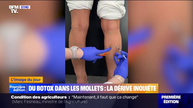 S'injecter du botox dans les mollets pour les affiner: la dernière dangereuse tendance sur Tiktok