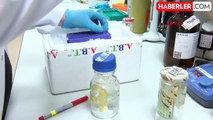 Ankara Üniversitesi Kök Hücre Enstitüsü'nde SMA Hastalığı İçin İlaç Test Kit Geliştiriliyor
