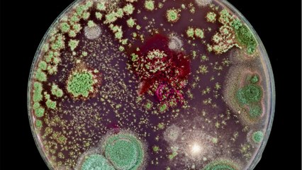 Doctors discover new type of bacteria in London hospital