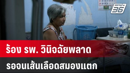 ร้อง รพ. วินิจฉัยพลาด รอจนเส้นเลือดสมองแตก | 24 ม.ค. 67 | เข้มข่าวใหญ่