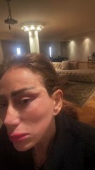 فيديو ريهام سعيد بعد تشوه ملامحها بسبب التجميل