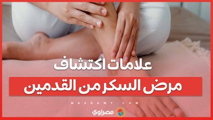علامات يمكنك اكتشافها على قدميك تشير  لارتفاع نسبة السكر في الدم  ... ما هى ؟