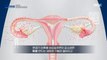 [HOT] Why Osteoporosis Treatment In Women Is More Important After Completion, MBC 다큐프라임 240121