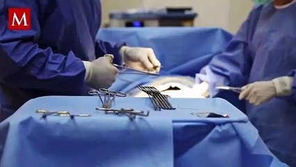 Así es el procedimiento quirúrgico por el que tiktoker de veinte años falleció