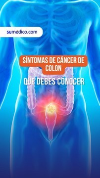 Síntomas de cáncer de colon que debes conocer