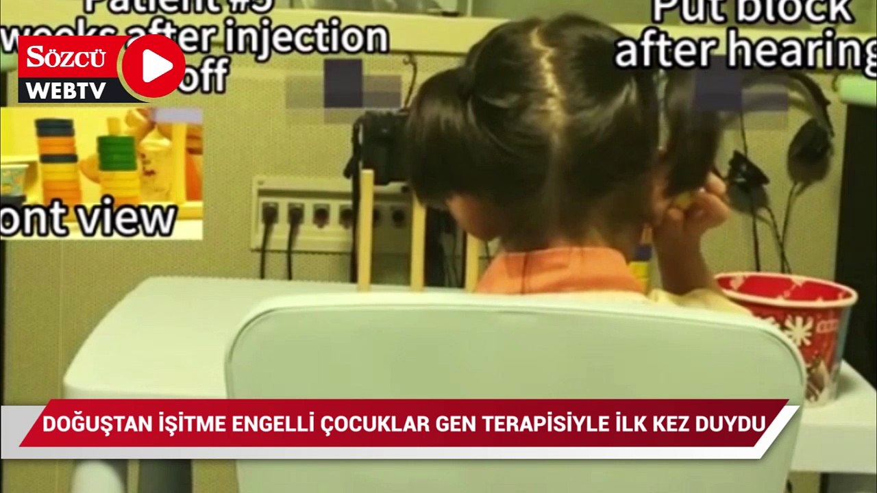 Doğuştan işitme engelli çocuklar gen terapisiyle ilk kez duydu
