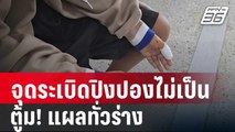 เด็ก 10 ขวบ จุดระเบิดปิงปองไม่เป็น ตู้ม! แผลทั่วร่าง | เข้มข่าวค่ำ | 26 ม.ค. 67