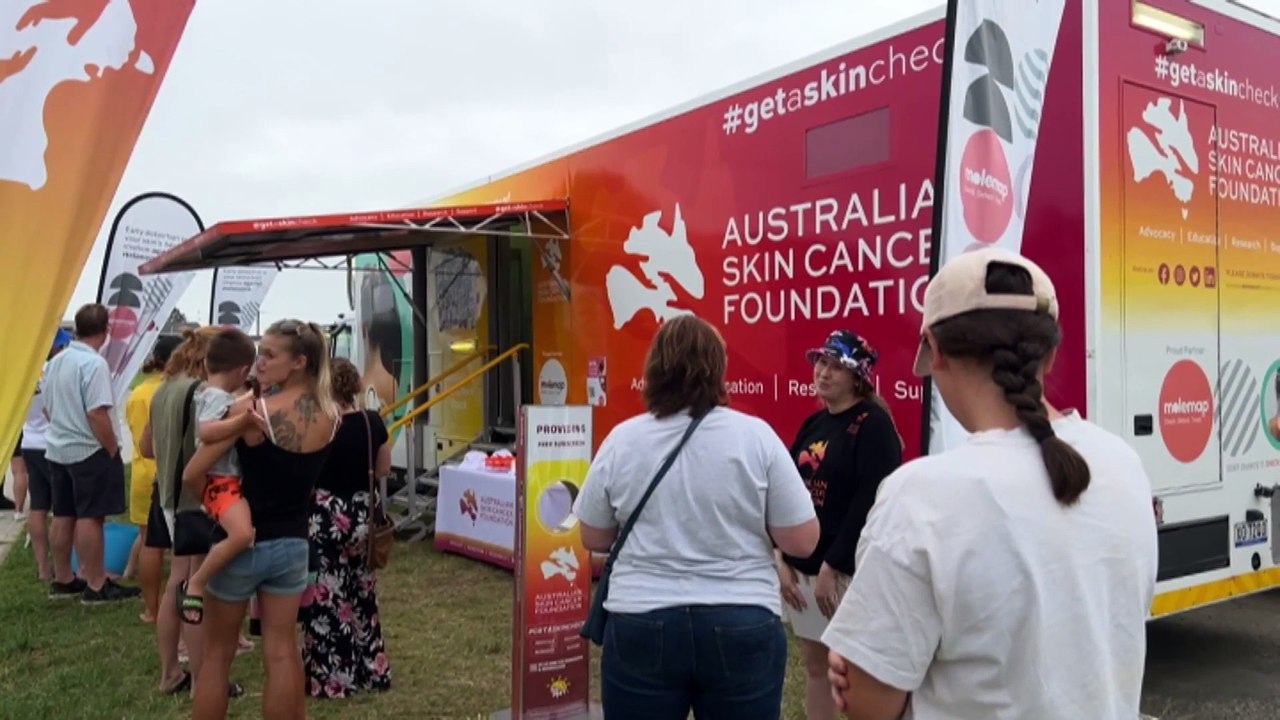 Skin cancer experts say Australia's tanning culture is "killing us"