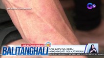 Mahigit 100 taga-Lapu-Lapu sa Cebu, nakararanas ng pangangati ng katawan | BT