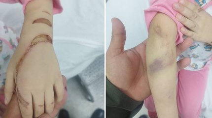Pareja fue capturada por quemar con la estufa a sus hijos de 4 y 5 años