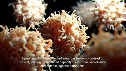 @ Understanding the Lymphatic System and Lymphedema