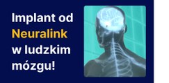 Implant od Neuralink w ludzkim mózgu!