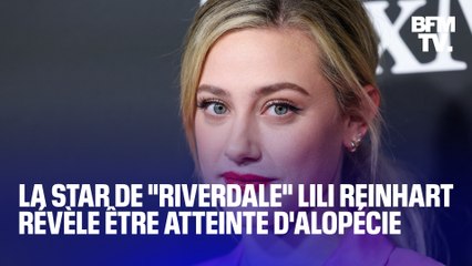 La star de “Riverdale” Lili Reinhart révèle être atteinte d’alopécie