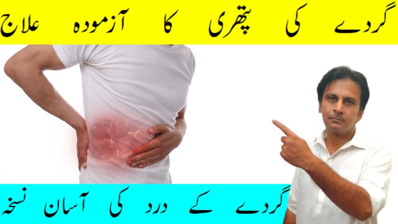 Gurde ki pathri ka ilaj | Kidney Stone Treatment | Kidney stone ka ilaj | Arshad mens health channel
