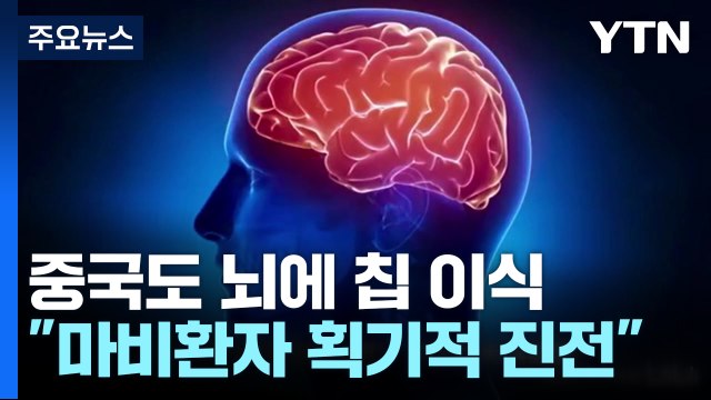 중국도 뇌에 무선 컴퓨터 장치 이식... 마비환자 획기적 진전 / YTN