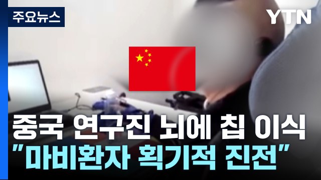 중국도 뇌에 무선 컴퓨터 장치 이식... 마비환자 획기적 진전 / YTN