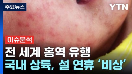 [뉴스라이더] 유럽에서 45배 폭증한 이 병, 국내 상륙...설 연휴 어쩌나? / YTN