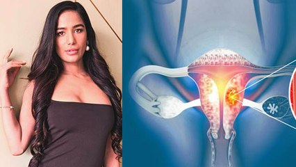 Télécharger la video: Poonam Pandey 32 Age Demise Reason Reveal, Cervical Cancer की Last Stage...| Boldsky