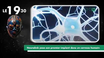 [#Reportage] Neuralink pose son premier implant dans un cerveau humain