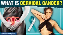 Poonam Pandey Passes Away due to Cervical Cancer | It also got a mention in Budget 2024 | Oneindia
