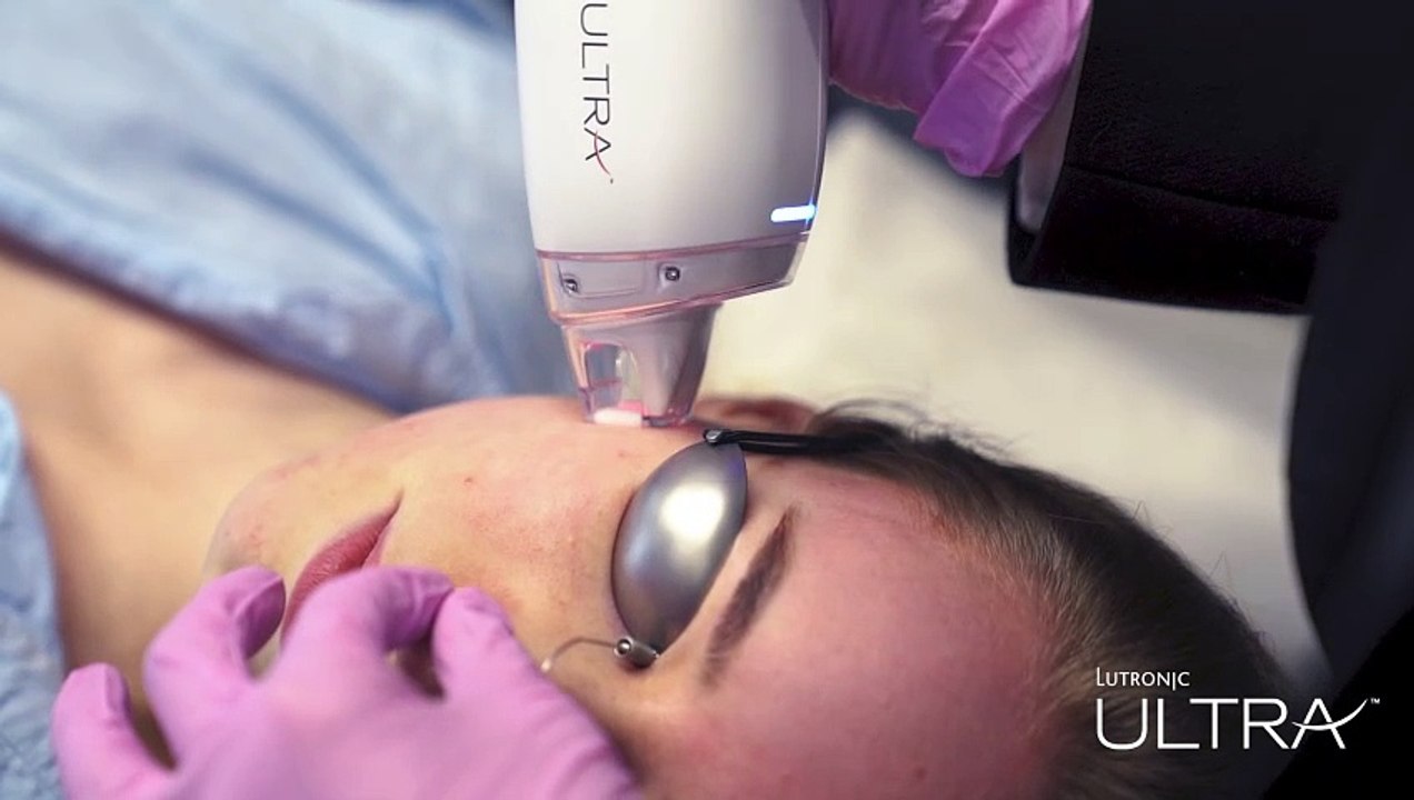 Lutronic Ultra