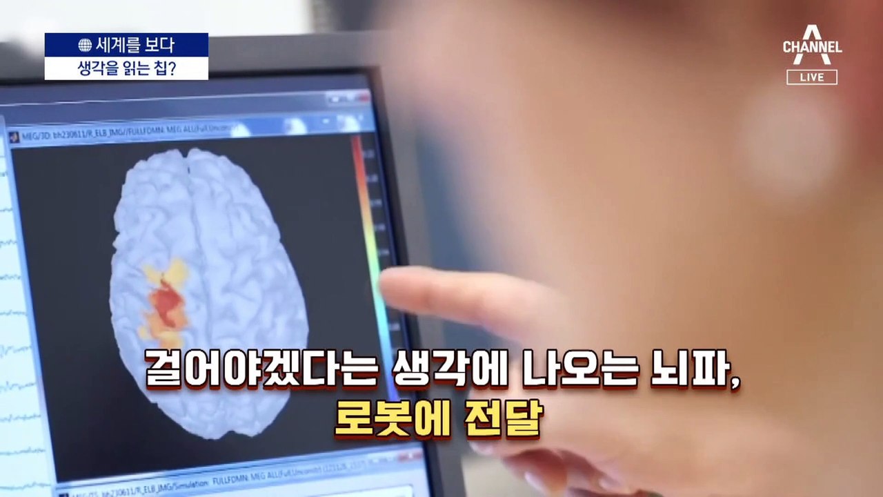 [세계를 보다]‘뇌 안에 칩’ 심어 컴퓨터와 소통 경쟁