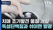 혈액으로 치매 유발 물질 조기 발견...초고속 검사 시스템 개발 박차 / YTN
